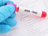 Ręka w niebieskiej rękawiczce trzyma probówkę z krwią do testu ANA. Na formularzu zaznaczono ANA.