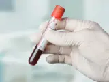Rękawiczka ft4 trzyma probówkę z ciemną cieczą, gotową do analizy.