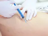 Lekarz w białej rękawiczce wykonuje zastrzyk strzykawką w nogę z widocznymi naczynkami. To skleroterapia żylaków opinie.