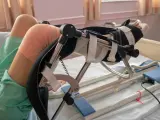 Osoba w łóżku z unieruchomioną nogą w aparacie ortopedycznym. Pamiętaj, czego nie wolno robić po endoprotezie kolana, by uniknąć powikłań.
