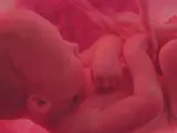 Dziecko w łonie matki, otoczone pępowiną. Obraz symbolizuje modlitwę w intencji nienarodzonego dziecka i jego zdrowia.