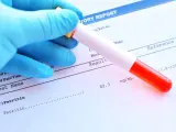 Ręka w niebieskiej rękawiczce trzyma probówkę z krwią nad raportem laboratoryjnym. Wynik badania ferrytyny to 62.3 ng/mL.