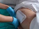 Rękawiczki chirurgiczne zakładane na udo pacjenta, przygotowanie do zastosowania nowoczesnych metod leczenia ran przewlekłych.