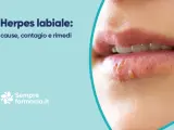 Herpes labiale: cause, contagio e rimedi. Scopri come curare l'herpes labiale e alleviare i sintomi.