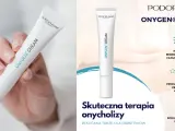 Krem ONYGEN® do intensywnej regeneracji paznokci dłoni i stóp, polecany w terapii onycholizy.