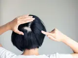 Eine Frau entdeckt kreisrunden Haarausfall am Hinterkopf. Ihre Hände berühren die kahle Stelle, die sich deutlich vom dunklen Haar abhebt.