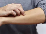 Juckende Haut am Arm, ein mögliches Symptom bei zu viel Zink.