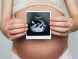 Ciężarna kobieta trzyma zdjęcie USG, na którym widać dziecko. Widać też łożysko na przedniej ścianie.