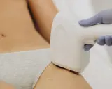 Depilacja laserowa bikini: Czy wiesz, jak to działa? Pełny przewodnik