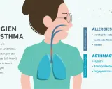 Illustration zeigt, was tun bei allergischem Asthma: Symptome wie Niesen, Husten und Atemprobleme. Allergene reizen die Atemwege.