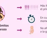 Ilustración de mujer con náuseas y vómitos en el embarazo, más comunes en el primer trimestre, pueden ocurrir a cualquier hora y no afectan la gestación.
