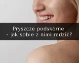 Bolesny pryszcz podskórny: Jak się pozbyć i szybko złagodzić ból?