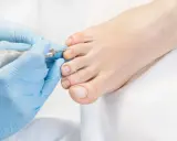 Un podologue réalise une pédicure avec un appareil rotatif sur les ongles d'un pied.