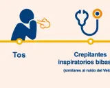Fibrosis pulmonar: ¿Reconoces sus síntomas? Guía esencial
