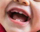 Uśmiechnięte dziecko z widocznymi ząbkami, które mogą wskazywać na nieprawidłową kolejność wyrzynania się zębów.