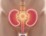Anatomia układu moczowego z nerkami i pęcherzem. Ilustracja pokazuje, jak rozpuścić kamień w pęcherzu moczowym.