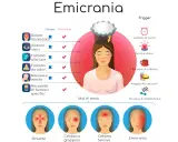 Le **emicrania cause** includono dolore localizzato, sintomi visivi, fastidio a luce/odori, nausea, vomito e necessità di farmaci specifici.