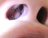 Primo piano delle narici, con peli visibili. Una speranza per chi soffre di polipi nasali: possono regredire.