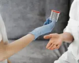 Ręka w niebieskiej rękawiczce podaje pojemnik na mocz, sugerując badanie, jak wypłukać cukier z moczu.