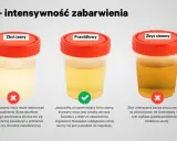 Jasny, prawidłowy i ciemny mocz. Intensywnie pomarańczowy mocz po nocy może świadczyć o odwodnieniu.