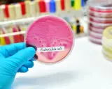 Różowa pożywka z koloniami bakterii Escherichia coli. Badanie pomaga wykryć bakteria coli objawy.