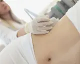 Ärztin untersucht Bauch einer Frau mit Ultraschall, um Schmerzen linke Seite Taille zu diagnostizieren.