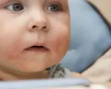 Czerwone policzki u rocznego dziecka mogą świadczyć o alergii pokarmowej.