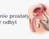 Ilustracja przedstawia badanie per rectum. Dłoń w rękawiczce bada prostatę, co może pomóc w diagnostyce problemów z zatrzymaniem moczu u mężczyzny.
