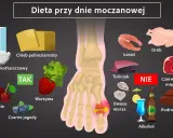 Dieta przy dnie moczanowej: jedz nabiał, warzywa, owoce (wiśnie, jagody). Unikaj czerwonego mięsa, podrobów, alkoholu, owoców morza. Jak obniżyć kwas moczowy? Zmień dietę!