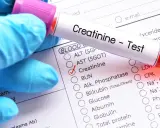 Ręka w niebieskiej rękawiczce trzyma probówkę z napisem "Creatinine - Test". Obok widoczny formularz z zaznaczonym badaniem kreatynina.