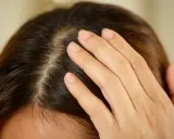 Main d'une femme effleurant son cuir chevelu, peut-être pour vérifier un kyste ou une irritation.