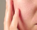 Gros plan sur la joue d'une personne, montrant les pores de la peau. Des doigts effleurent délicatement la surface.