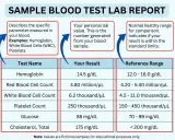 Przykładowy **jonogram** z wynikami badań krwi: hemoglobina, erytrocyty, leukocyty, płytki, glukoza, cholesterol.