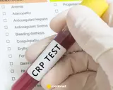 Ręka w rękawiczce trzyma probówkę z krwią z napisem "CRP TEST" na tle listy badań.