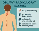 Grafika ilustruje objawy radikulopatii szyjnej: piekący ból kręgosłupa szyjnego, mrowienie, osłabienie mięśni i zaburzenia koordynacji.
