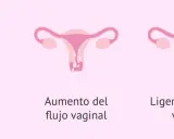 Cambios en pechos, aumento de flujo vaginal y ligero sangrado vaginal. Posible retraso menstrual.