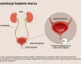 Ilustracja układu moczowego z zaznaczonymi nerkami, moczowodami i pęcherzem. Widoczne bakterie pałeczki w moczu, mogące świadczyć o infekcji.