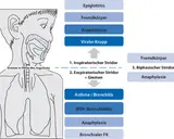 Schema zeigt Ursachen für Atemnot: Epiglottitis, Fremdkörper, Anaphylaxie, Krupp. Warum kriege ich schlecht Luft? Hier sind mögliche Gründe.