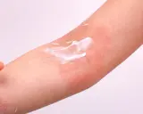 Application de crème sur une plaque sèche et rouge sur le bras, soulageant l'irritation cutanée.
