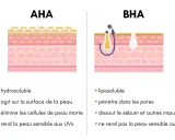 Comparaison AHA et BHA : l'un agit en surface, l'autre pénètre les pores pour dissoudre le sébum. Aha, le BHA est liposoluble !