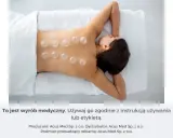 Kobieta leży na plecach, na jej kręgosłupie umieszczono przezroczyste bańki.