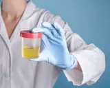 Ręka w niebieskiej rękawiczce trzyma pojemnik z żółtym płynem, sugerując badanie na obecność glukozy w moczu.