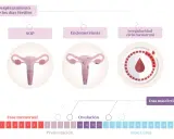 Ilustración del ciclo menstrual y condiciones que afectan la fertilidad. Puedes quedar embarazada si tienes relaciones sexuales en tus días fértiles, incluso si hay irregularidades.