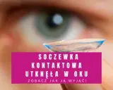 Nie mogę znaleźć soczewki w oku? Zobacz, jak wyjąć soczewkę kontaktową, która utknęła w oku.