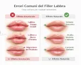 Confronto tra filler labbra tecniche: effetti innaturali (labbra troppo grandi, a becco d'anatra, migrazione) e naturali (volume armonico, profilo morbido, contorni definiti).