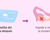 Pastilla del día después: su efecto es impedir o retrasar la ovulación, lo que puede afectar tu ciclo menstrual.
