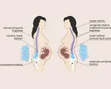 Zmiany w kręgosłupie w ciąży: naturalna krzywizna vs. zwiększona, przesunięty środek ciężkości. Choroby ginekologiczne a ból kręgosłupa.