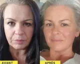 Avant/Après : une femme avant et après avoir pris du collagène. Sa peau semble plus lisse et radieuse.
