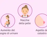 Il sesto mese di gravidanza porta smagliature, macchie sulla pelle, aumento del bisogno di urinare, colostro e problemi alla schiena.