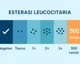 Scala di esterasi leucocitaria: da negativo a 3+, con 500 Leu/µL. Preoccuparsi se i valori aumentano.
